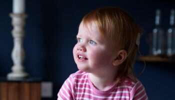 Bebe Grâce à une thérapie génique, un bébé né sourd au Royaume-Uni peut désormais entendre pour la première fois